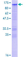 DIAPH3 / MDIA2 Protein - 12.5% SDS-PAGE of human DIAPH3 stained with Coomassie Blue