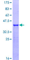 DIAPH3 / MDIA2 Protein - 12.5% SDS-PAGE Stained with Coomassie Blue.
