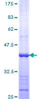 DICER1 / Dicer Protein - 12.5% SDS-PAGE Stained with Coomassie Blue.