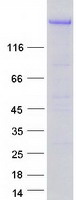 DICER1 / Dicer Protein - Purified recombinant protein DICER1 was analyzed by SDS-PAGE gel and Coomassie Blue Staining