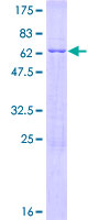 DIMT1L Protein - 12.5% SDS-PAGE of human DIMT1L stained with Coomassie Blue