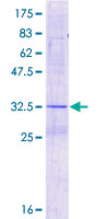 DIO1 / TXDI1 Protein - 12.5% SDS-PAGE of human DIO1 stained with Coomassie Blue