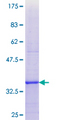 DIO1 / TXDI1 Protein - 12.5% SDS-PAGE Stained with Coomassie Blue.
