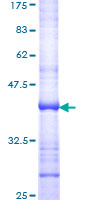 DIO2 Protein - 12.5% SDS-PAGE Stained with Coomassie Blue.