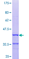 DIO3 Protein - 12.5% SDS-PAGE Stained with Coomassie Blue.