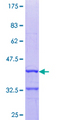 DIO3 Protein - 12.5% SDS-PAGE Stained with Coomassie Blue.