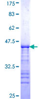 DIP2A Protein - 12.5% SDS-PAGE Stained with Coomassie Blue.
