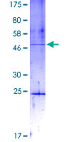 DIP2A Protein - 12.5% SDS-PAGE Stained with Coomassie Blue.