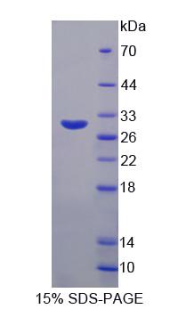 Dipeptidyl Peptidase 3 / DPP3 Protein - Recombinant Dipeptidyl Peptidase 3 (DPP3) by SDS-PAGE