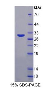 Dipeptidyl Peptidase 3 / DPP3 Protein - Recombinant Dipeptidyl Peptidase 3 (DPP3) by SDS-PAGE