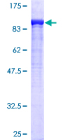 Dipeptidyl Peptidase 3 / DPP3 Protein - 12.5% SDS-PAGE of human DPP3 stained with Coomassie Blue