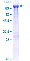 Dipeptidyl Peptidase 3 / DPP3 Protein - 12.5% SDS-PAGE of human DPP3 stained with Coomassie Blue