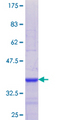 Dipeptidyl Peptidase 3 / DPP3 Protein - 12.5% SDS-PAGE Stained with Coomassie Blue.