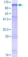 Dipeptidylpeptidase 10 / DPP10 Protein - 12.5% SDS-PAGE of human DPP10 stained with Coomassie Blue