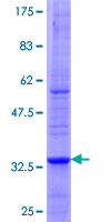 Dipeptidylpeptidase 10 / DPP10 Protein - 12.5% SDS-PAGE Stained with Coomassie Blue.