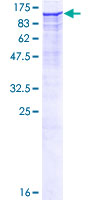 Dipeptidylpeptidase 8 / DPP8 Protein - 12.5% SDS-PAGE of human DPP8 stained with Coomassie Blue