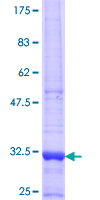 Dipeptidylpeptidase 8 / DPP8 Protein - 12.5% SDS-PAGE Stained with Coomassie Blue.