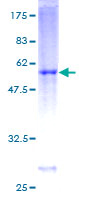 DIRAS3 / ARHI Protein - 12.5% SDS-PAGE of human DIRAS3 stained with Coomassie Blue