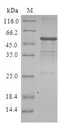 DIRAS3 / ARHI Protein - (Tris-Glycine gel) Discontinuous SDS-PAGE (reduced) with 5% enrichment gel and 15% separation gel.
