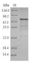 DIRAS3 / ARHI Protein - (Tris-Glycine gel) Discontinuous SDS-PAGE (reduced) with 5% enrichment gel and 15% separation gel.