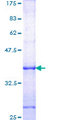 DIRAS3 / ARHI Protein - 12.5% SDS-PAGE Stained with Coomassie Blue.