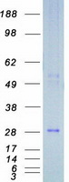 DIRAS3 / ARHI Protein - Purified recombinant protein DIRAS3 was analyzed by SDS-PAGE gel and Coomassie Blue Staining
