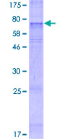 DIRC2 / RCC4 Protein - 12.5% SDS-PAGE of human DIRC2 stained with Coomassie Blue