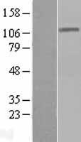 DIS3 Protein - Western validation with an anti-DDK antibody * L: Control HEK293 lysate R: Over-expression lysate