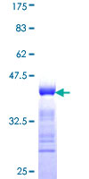 DIS3 Protein - 12.5% SDS-PAGE Stained with Coomassie Blue.