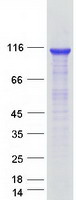 DIS3 Protein - Purified recombinant protein DIS3 was analyzed by SDS-PAGE gel and Coomassie Blue Staining