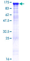 DIS3L Protein - 12.5% SDS-PAGE of human DIS3L stained with Coomassie Blue