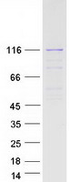 DIS3L Protein - Purified recombinant protein DIS3L was analyzed by SDS-PAGE gel and Coomassie Blue Staining