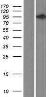 DIS3L2 Protein - Western validation with an anti-DDK antibody * L: Control HEK293 lysate R: Over-expression lysate