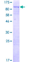 DIS3L2 Protein - 12.5% SDS-PAGE of human DIS3L2 stained with Coomassie Blue