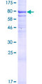 DISPA / DISP1 Protein - 12.5% SDS-PAGE of human DISP1 stained with Coomassie Blue