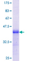 DISPA / DISP1 Protein - 12.5% SDS-PAGE Stained with Coomassie Blue.