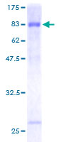 DIXDC1 Protein - 12.5% SDS-PAGE of human DIXDC1 stained with Coomassie Blue