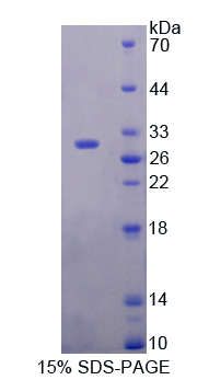 DIXDC1 Protein - Recombinant  DIX Domain Containing Protein 1 By SDS-PAGE