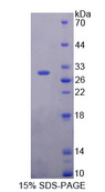 DIXDC1 Protein - Recombinant  DIX Domain Containing Protein 1 By SDS-PAGE