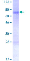 DJ858B16.2 / PISD Protein - 12.5% SDS-PAGE of human PISD stained with Coomassie Blue