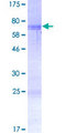 DJ858B16.2 / PISD Protein - 12.5% SDS-PAGE of human PISD stained with Coomassie Blue