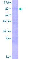 DKC1 / Dyskerin Protein - 12.5% SDS-PAGE of human DKC1 stained with Coomassie Blue