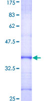 DKC1 / Dyskerin Protein - 12.5% SDS-PAGE Stained with Coomassie Blue.