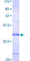 DKC1 / Dyskerin Protein - 12.5% SDS-PAGE Stained with Coomassie Blue.