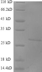 DKK1 Protein - (Tris-Glycine gel) Discontinuous SDS-PAGE (reduced) with 5% enrichment gel and 15% separation gel.