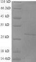 DKK1 Protein - (Tris-Glycine gel) Discontinuous SDS-PAGE (reduced) with 5% enrichment gel and 15% separation gel.
