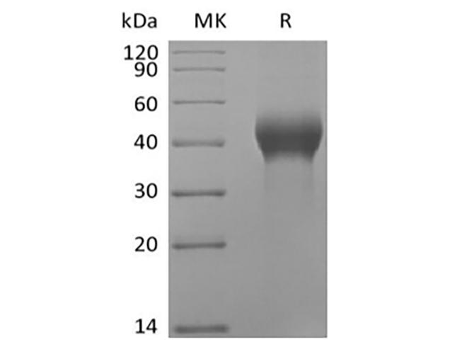 DKK1 Protein - Recombinant Human Dickkopf-Related Protein 1/DKK-1 (C-Avi-6His) Biotinylated