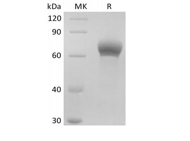 DKK1 Protein - Recombinant Human Dickkopf-Related Protein 1/DKK-1 (C-Fc)
