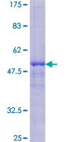 DKK1 Protein - 12.5% SDS-PAGE of human DKK1 stained with Coomassie Blue