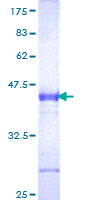 DKK1 Protein - 12.5% SDS-PAGE Stained with Coomassie Blue.